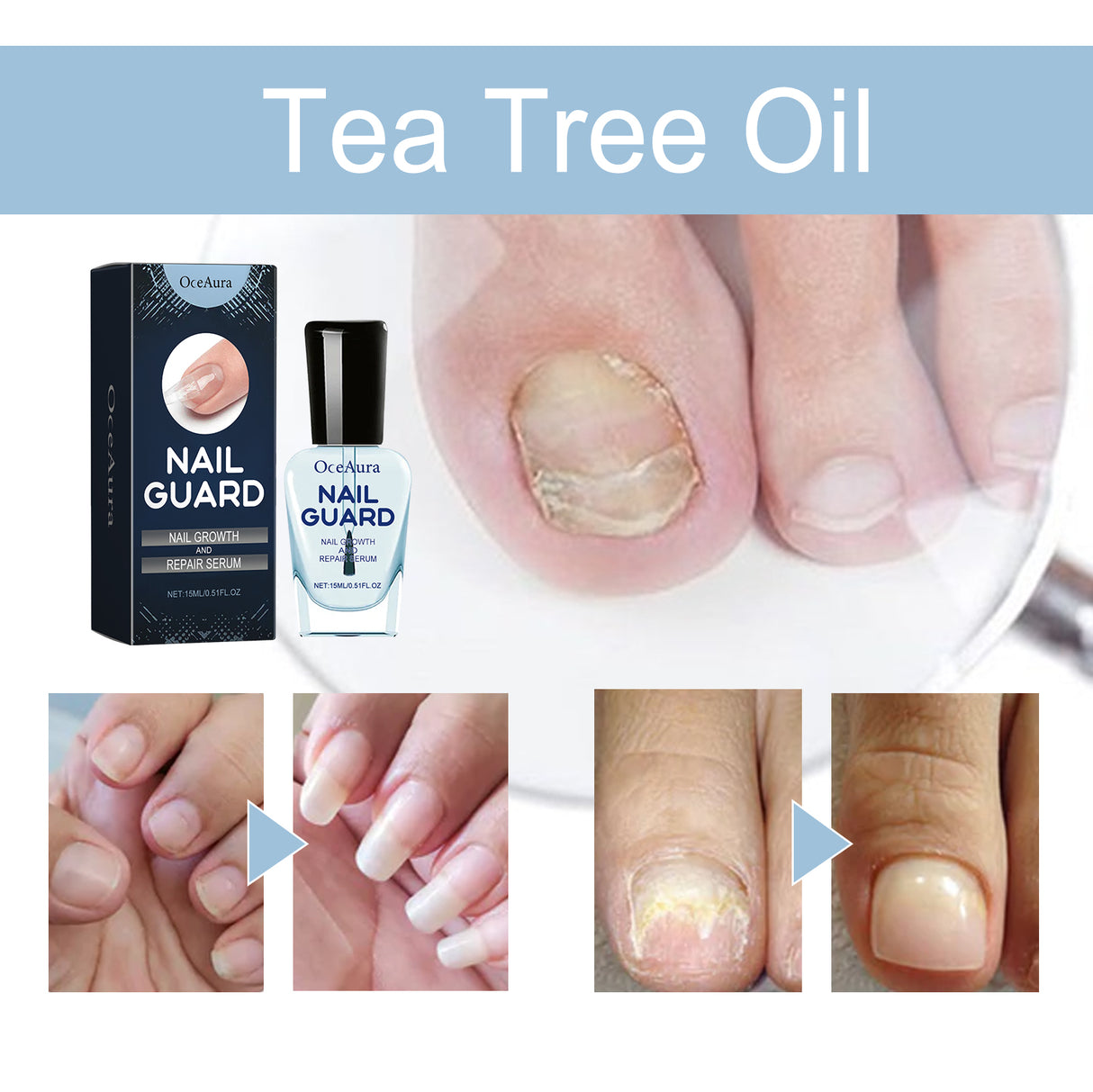 OCEAURA Nail Repair Lotion, Foot And Nail Nourishing Repair Soft Nails Gentle Clean Bright Nails Care - V.I.P Digital Presence