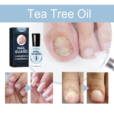 OCEAURA Nail Repair Lotion, Foot And Nail Nourishing Repair Soft Nails Gentle Clean Bright Nails Care - V.I.P Digital Presence