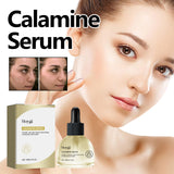 Calamine Serum, Improve Skin Dry Dull Acne Muscle Acne Hydrating Plump - V.I.P Digital Presence