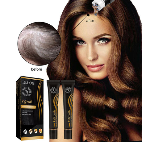 EELHOE Ball Bearing Dense Hair Essential Oil Thick Sparse Hair Bead Massage Scalp Care Fluid To Prevent The Loss Of Essential Oil - V.I.P Digital Presence