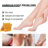 Anti-Crack Hand And Foot Care Cream Moisturizes Skin To Prevent Dry Cracking, Peeling, Freezing And Chapping
