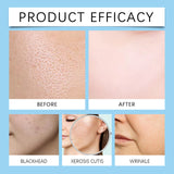 Hyaluronic Acid Face Serum, Compact Light Stripes Desalt Blain Brightens The Hydrating Essence - V.I.P Digital Presence