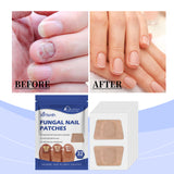 Nail Care Patches Gently Repair Nails For Easy Daily Cleaning With Simple Care Patches - V.I.P Digital Presence