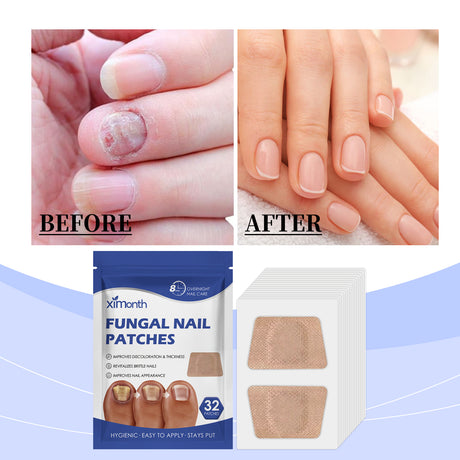 Nail Care Patches Gently Repair Nails For Easy Daily Cleaning With Simple Care Patches - V.I.P Digital Presence