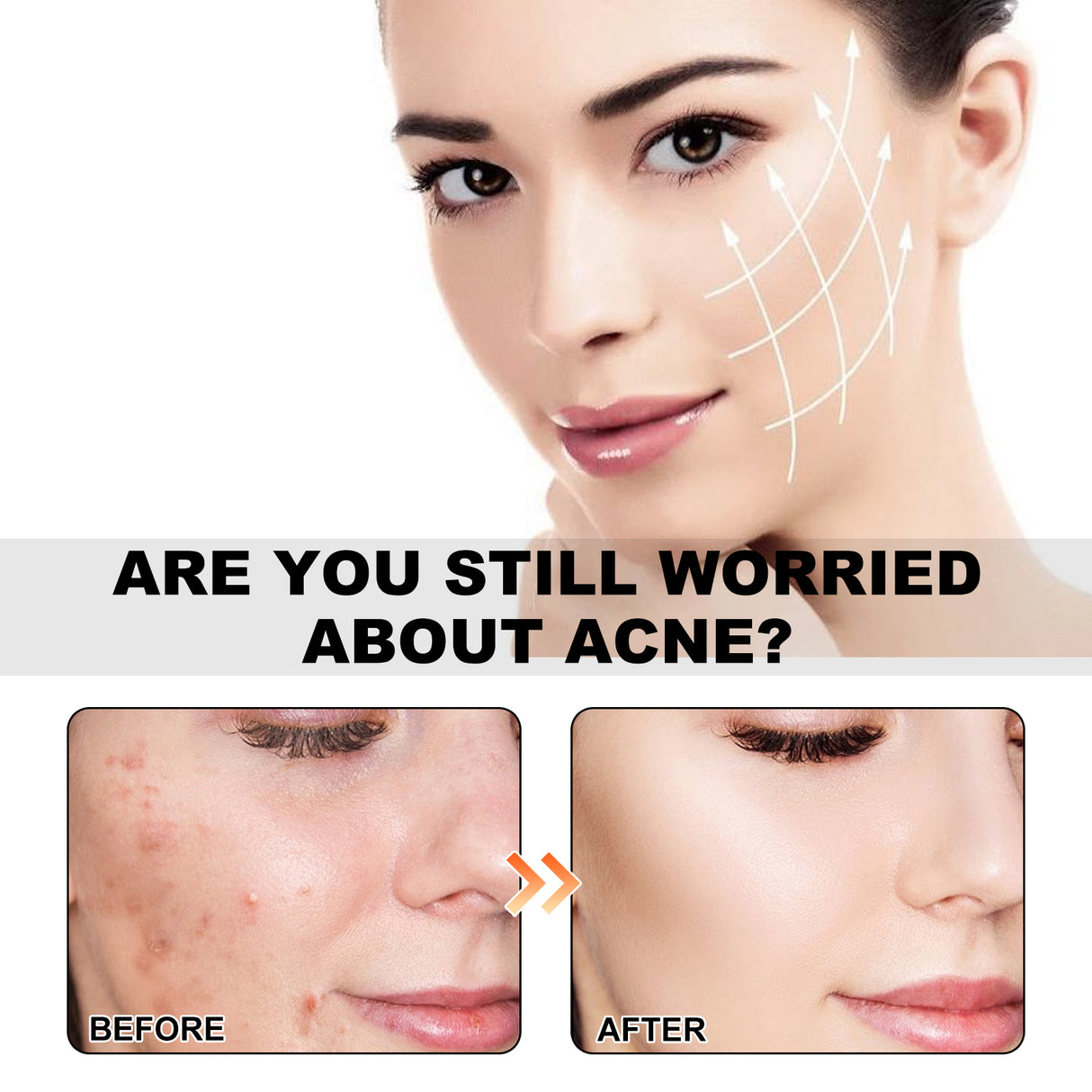 Sea Life Pattern Acne Patches, Lighten Acne Acne Repair Facial Skin Concealer Acne Patch