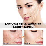 Sea Life Pattern Acne Patches, Lighten Acne Acne Repair Facial Skin Concealer Acne Patch