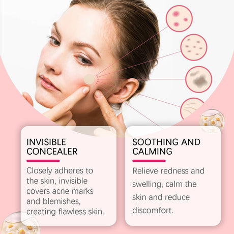 Repair Acne Patch, Facial Cleansing Cover Acne Skin Moisturizing Gentle Skin Cream - V.I.P Digital Presence