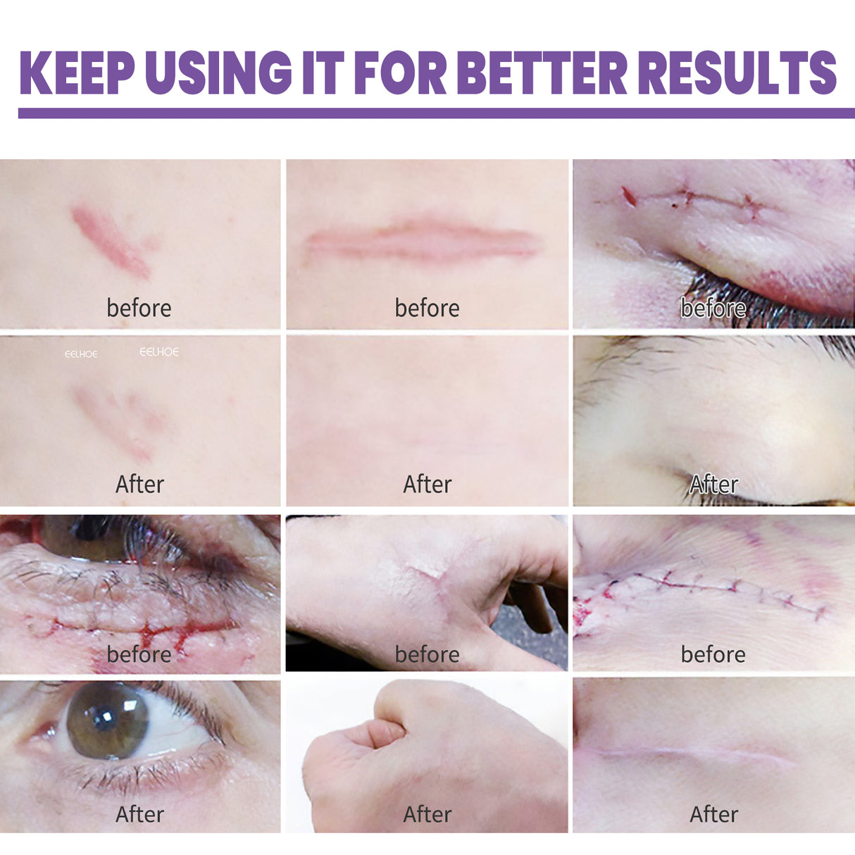 Skin Care Cream, Daily Moisturizing, Smoothing And Firming Skin Repair Postpartum Repair Topical Cream - V.I.P Digital Presence