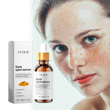 Dark Spot Serum, Hydrating Moist Firming Facial Skin Repair Skin Dark Bright Skin Care Essence - V.I.P Digital Presence