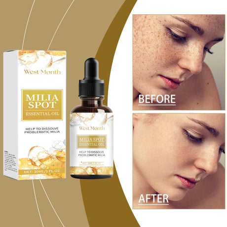 Facial Essential Oil, Brightening And Darkening Skin, Hydrating And Moisturizing Facial Essence - V.I.P Digital Presence