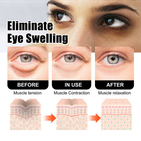 Snake Venom Peptide Eye Cream Gently Nourishes Skin, Reduces Fine Lines, Hydrates And Moisturizes Eye Cream - V.I.P Digital Presence