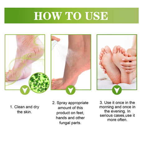 Fresh Foot Spray, Dry Feet Peeling Feet Itchy Moisturizing Skin Fragrance Spray - V.I.P Digital Presence
