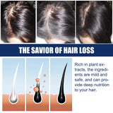 Alopecias Hair Growth Cream, Protect Hair Follicles Strong Moisturizing Thick Hairline Hair - V.I.P Digital Presence