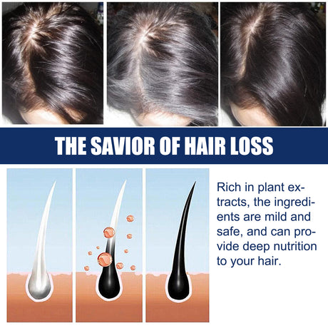 Alopecias Hair Growth Cream, Protect Hair Follicles Strong Moisturizing Thick Hairline Hair - V.I.P Digital Presence