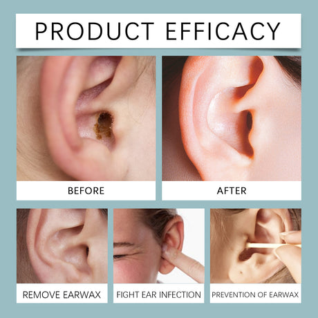 Anti Cochlear Blockage Removal Spray, Daily Gentle And Soothing Moisturizing Earwax Cleaning And Care Spray - V.I.P Digital Presence