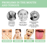 Fissured Tongue Relief Spray, Relieve Cracked Tongue And Fresh Breath Deodorizer Mouth Spray - V.I.P Digital Presence