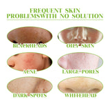 Green Tea Cleansing Mousse, A Deep Cleansing Facial Cleanser With Refreshing Oil Control And Wrinkles Reduction - V.I.P Digital Presence