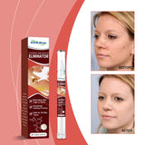 Keyu Pen, Gentle Skin Cleaning Soft Skin Moisturizing Repair Skin Care Pen - V.I.P Digital Presence