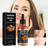 Batana Essential Oil, Hair Smoothing Anti-Loss Nourishing Skin Care Essential Oil - V.I.P Digital Presence