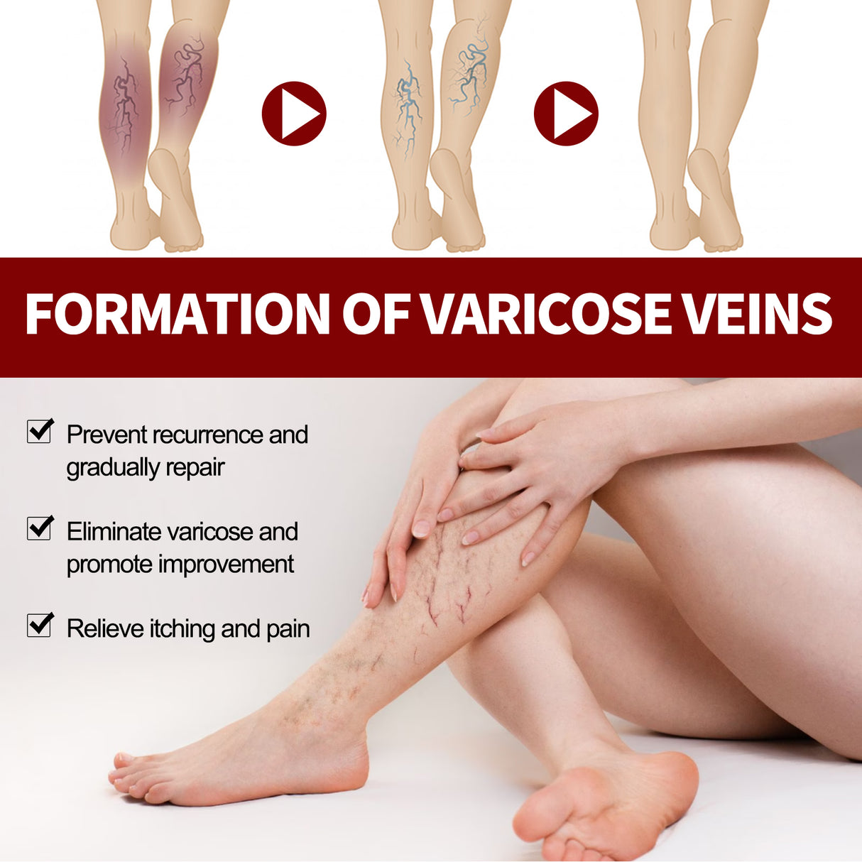 Veinmist Varicose Spray, Relief Sore Legs Massage Earthworm Leg Vein Treatment Spray - V.I.P Digital Presence