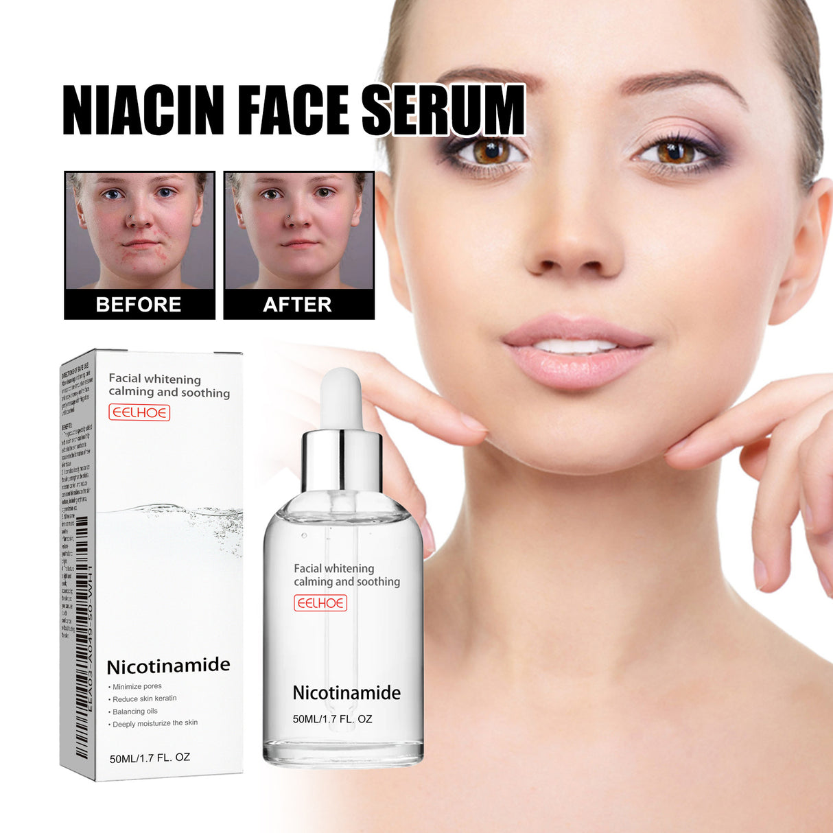 Nicotinic Acid Face Essence Lighten Acne Marks, Moisturize Pores, Shrink And Whiten Skin Beauty Essence - V.I.P Digital Presence