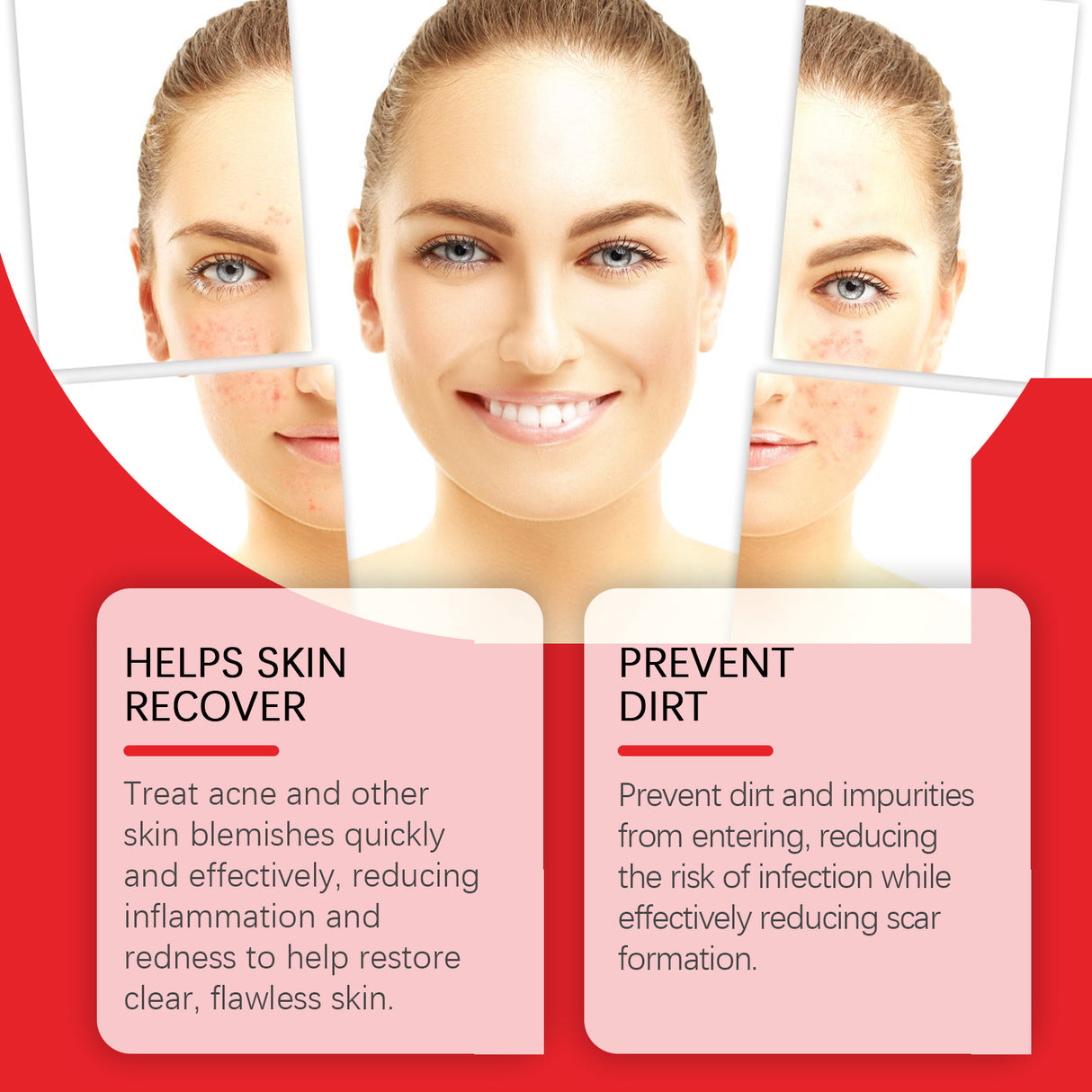 Blemish Acne Patch Clear Acne Face Cover Acne Care Facial Contact Patch