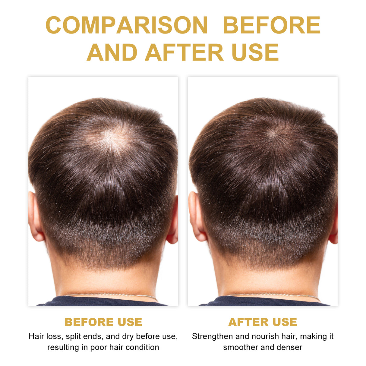 Hair Dense Oil, Scalp Cleaning Care Fluffy Soft Repair Dry Hair Impetuous Solid Hair Dense Hair Essential Oil - V.I.P Digital Presence