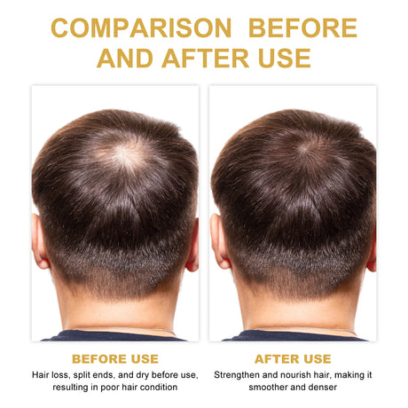 Hair Dense Oil, Scalp Cleaning Care Fluffy Soft Repair Dry Hair Impetuous Solid Hair Dense Hair Essential Oil - V.I.P Digital Presence