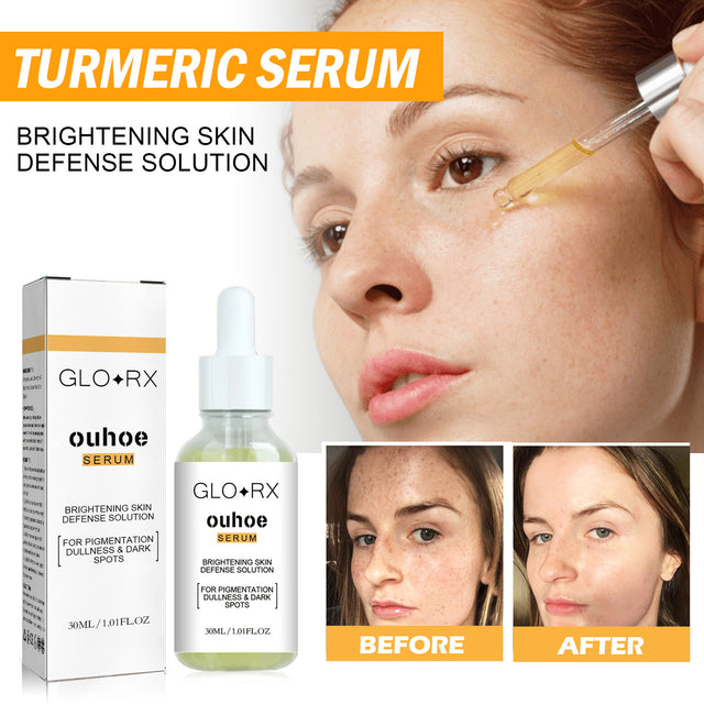 Turmeric Whitening Spot Serum, Lighten Freckle Spots Brightening Skin Hydrating Serum - V.I.P Digital Presence