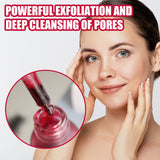 AHA30% + BHA 2% Fruit Acid Salicylic Acid Essence, Exfoliating Cleaning Blackheads Acne And Shrinking Pores Essence - V.I.P Digital Presence