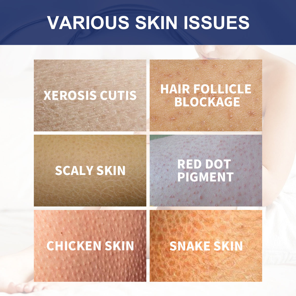 Body Whitening Scrub, Deep Body Cleansing Treatment Gently Exfoliates Dead Skin Whitening Skin - V.I.P Digital Presence