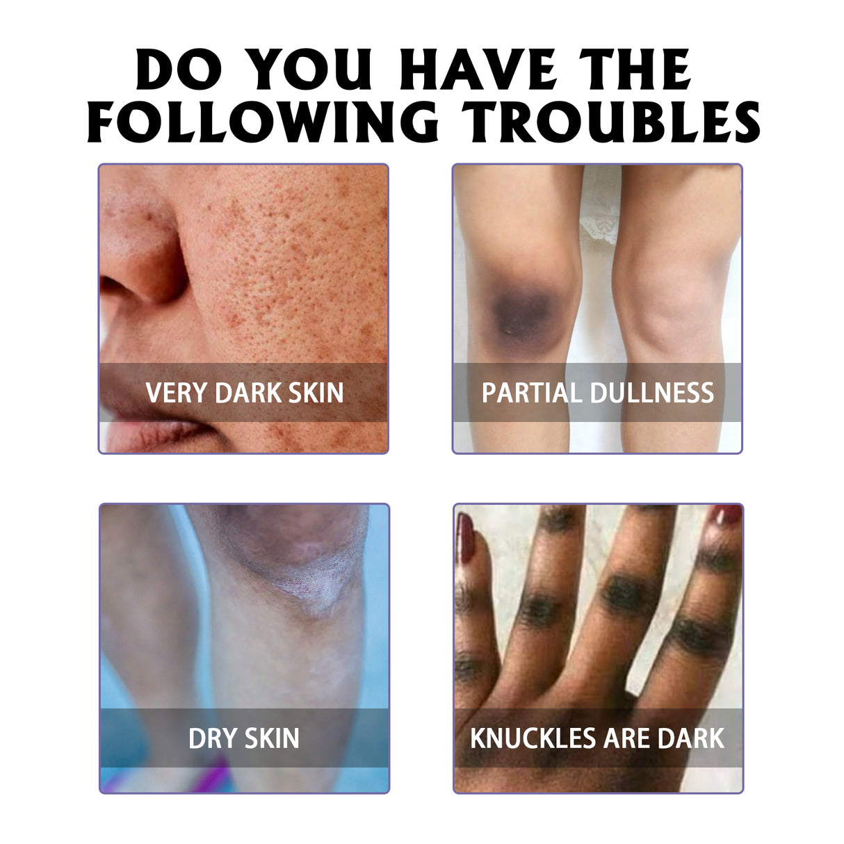 Whitening Skin, Lighten Dull Skin Elbow Black Hydrating, Brightening, Moisturizing And Rejuvenating Essence - V.I.P Digital Presence