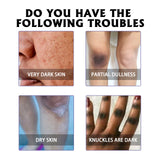 Whitening Skin, Lighten Dull Skin Elbow Black Hydrating, Brightening, Moisturizing And Rejuvenating Essence - V.I.P Digital Presence