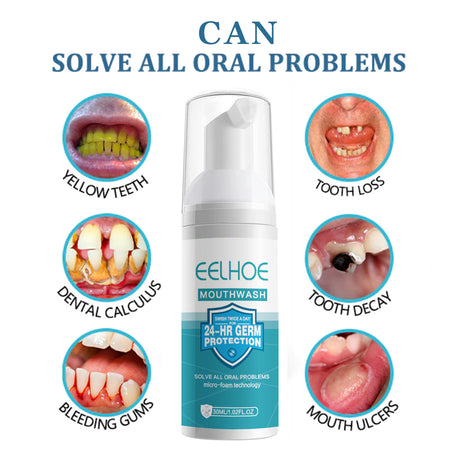 Dental Cleanser Mousse Anti-Decay Yellow Teeth Clean Smoke Stains And Tartar Fresh Breath Press Clean Teeth - V.I.P Digital Presence