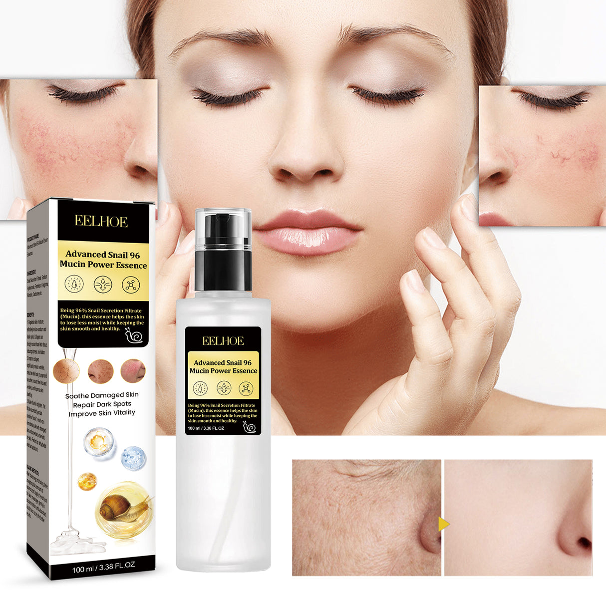 Snail 96 Collagen Essence Lighten Fine Lines, Tender Skin and Moisturize acne muscles - V.I.P Digital Presence