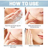 Wart Cream, Skin Clean And Smooth Wart Nevi Facial Care Cream - V.I.P Digital Presence