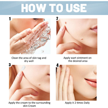 Wart Cream, Skin Clean And Smooth Wart Nevi Facial Care Cream - V.I.P Digital Presence