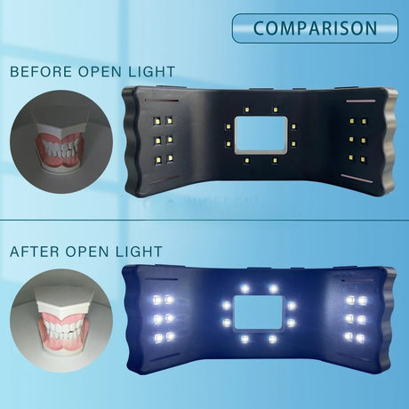 Dental oral fill light LED orthodontic dental fill light mobile phone universal handheld dental photography tool - V.I.P Digital Presence