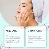 Azelaic Acid Acne Cream, Oil Control Gentle Moisturizing Acne Skin Moisturizing Daily Facial Cream - V.I.P Digital Presence