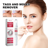 Skin Wart Lotion, Cleanses Skin And Removes Flat Eye Wart Lotion Especially Hand Cocoon - V.I.P Digital Presence