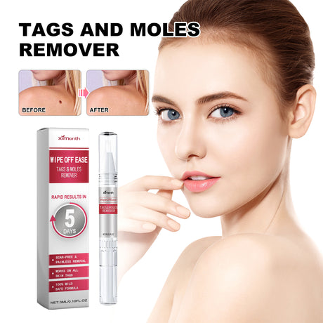 Skin Wart Lotion, Cleanses Skin And Removes Flat Eye Wart Lotion Especially Hand Cocoon - V.I.P Digital Presence