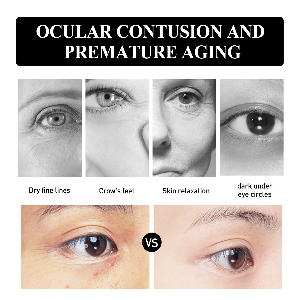 Snake Venom Peptide Moisturizing Eye Cream, Reduce Fine Line Eye Bags Hydrating, Anti-Aging And Anti-Wrinkle Eye Cream - V.I.P Digital Presence