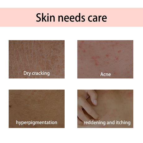 Handcrafted Body Oil, Hydrating And Moisturizing Essential Oil For Firming And Soothing Skin - V.I.P Digital Presence