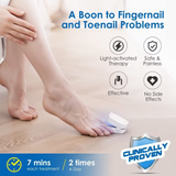 Portable onychomycosis auxiliary tool UV nail phototherapy lamp cleaning lamp fungus lamp - V.I.P Digital Presence