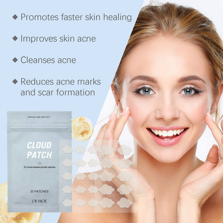 Cloud Acne Patch Repair Mild Facial Skin Clean Acne Skin Delicate Skin Care Patch - V.I.P Digital Presence