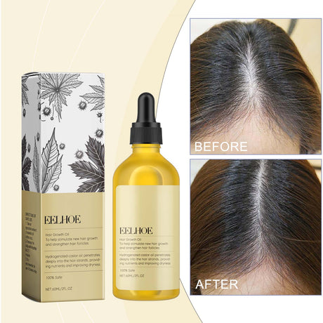 Castor Dense Hair Essential Oil Repair Dry And Damaged Scalp Hair Moist, Hydrating And Smoothing Hair - V.I.P Digital Presence