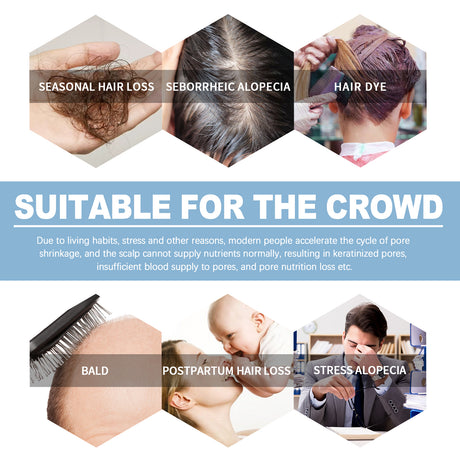 Hair Care Ampere Thick, Strong, Nutritious, Soft And Restorative Scalp Hair Root Massage Solution - V.I.P Digital Presence