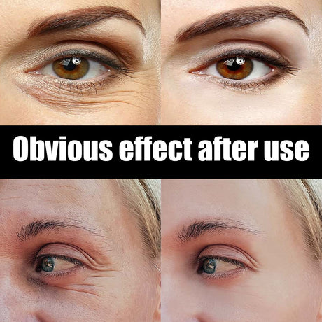 Astaxanthin Caviar Eye Cream, Moisturizing Skin Care Firming Fade Lines Eye Cream - V.I.P Digital Presence