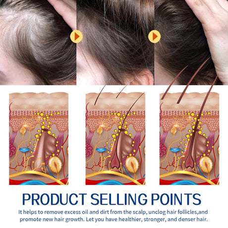 Hair Scrub Cleans Scalp Dandruff, Soothes Itchiness, Moisturizes Dense, Firming, And Prevents Hair Loss - V.I.P Digital Presence
