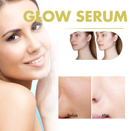 Glow Serum, Moisturizing And Whitening Skin To Reduce Facial Spots And Fine Lines - V.I.P Digital Presence